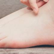 ¿Cómo quitar las durezas de tus pies?